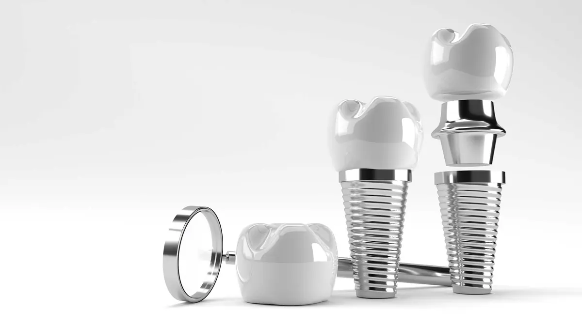 Dental implant components laid out for comparison