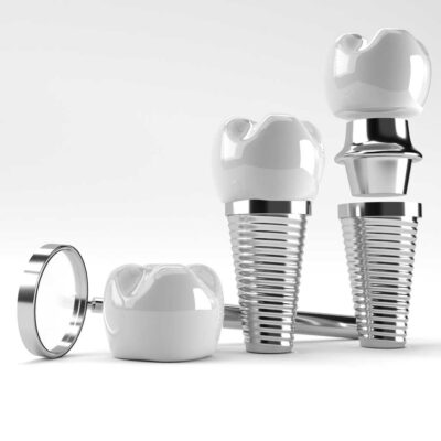 Gromov-Dental-Implants-bw-2-sq