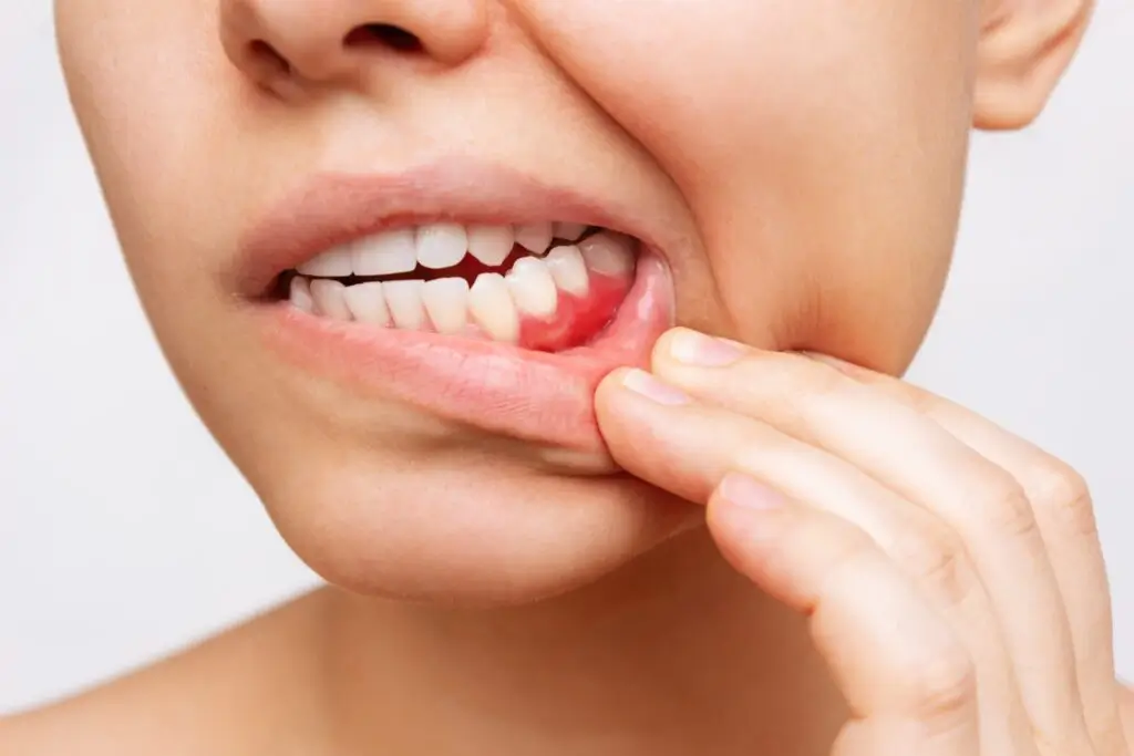 What does a periodontist do for gum disease