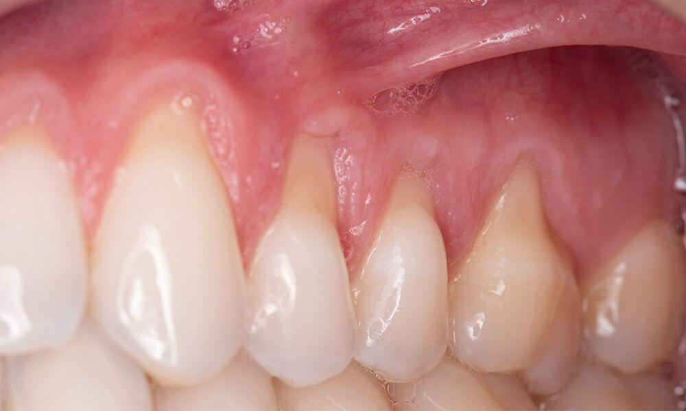 ctg case 05 before