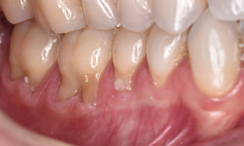 ctg case 06 before