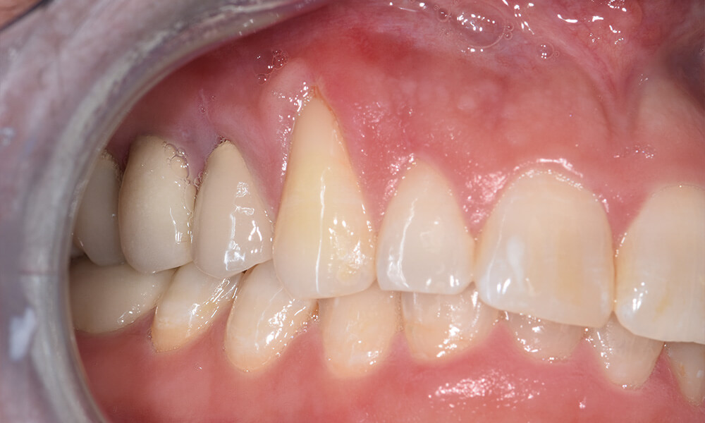 ctg intro case