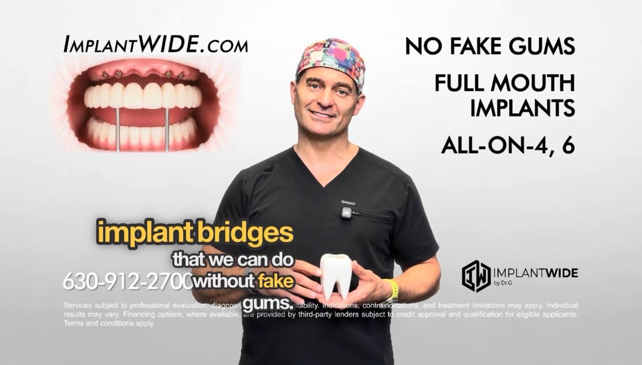 Dr. Gromov presenting All-on-4, 6, X full mouth implants with no fake gums